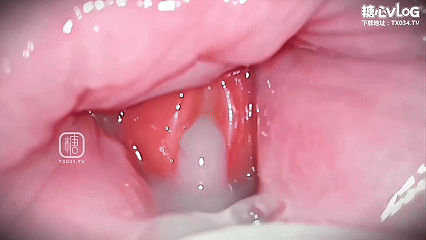 6月8日 (2)(3).gif